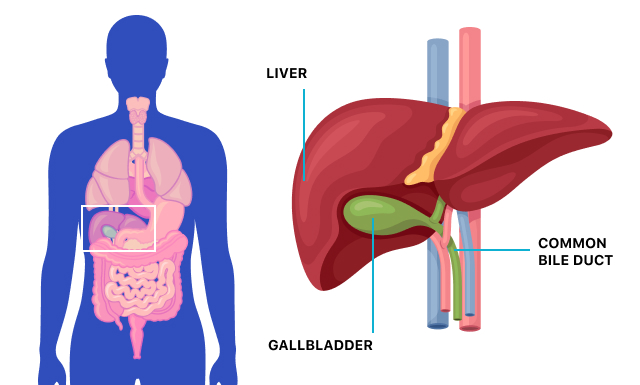 What causes gallbladder problems and diseases?