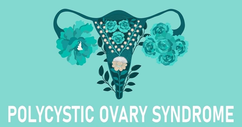 What are the treatment options for PCOD? Doctor Near Me