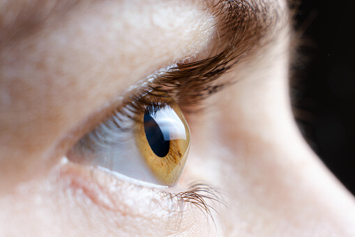 What is Keratoconus ?