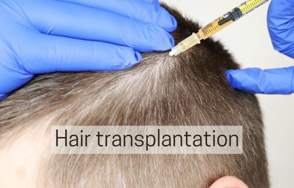 Who is eligible for Hair Transplantation? Doctor Near Me