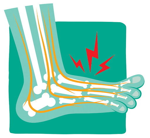 How is peripheral neuropathy diagnosed?