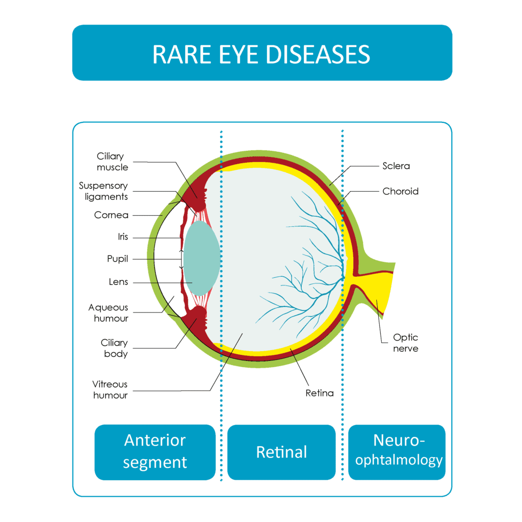 What are some unusual or rare eye conditions that most people are not aware of? Doctor Near Me
