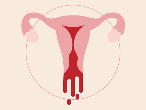 Is there a link between heavy menstrual bleeding and fertility issues?