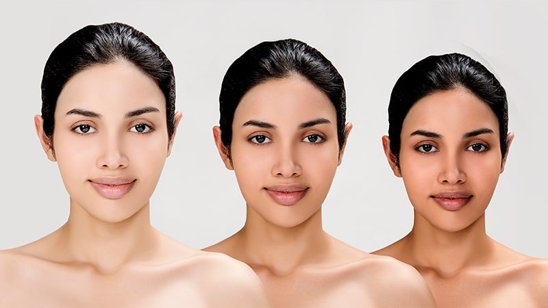 What are the common reasons people seek skin lightening treatments?