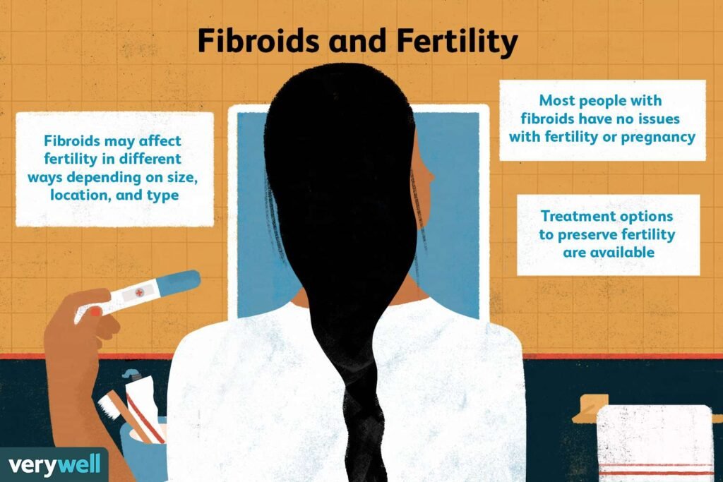 Can uterine fibroids affect fertility and pregnancy? Doctor Near Me