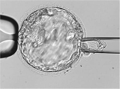 Can Pre-Implantation Genetic Testing determine the gender of the embryo?