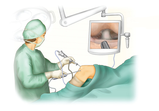 What conditions can be treated with arthroscopic surgery?