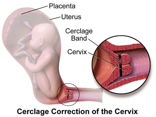 Gynecologist in Dahisar