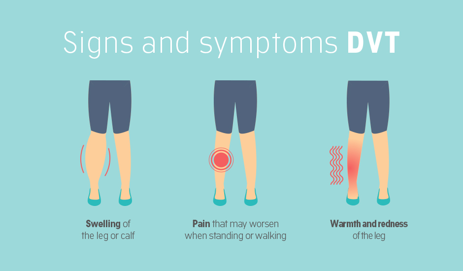 What are the symptoms of DVT?