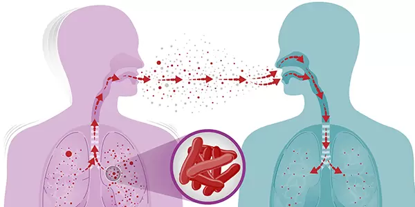 What are the symptoms of Tuberculosis?