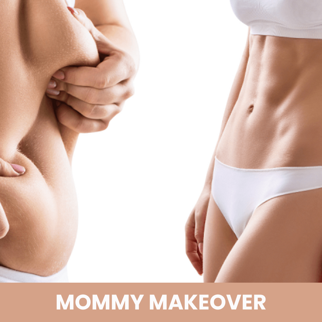 What are the common components of a Mommy Makeover?