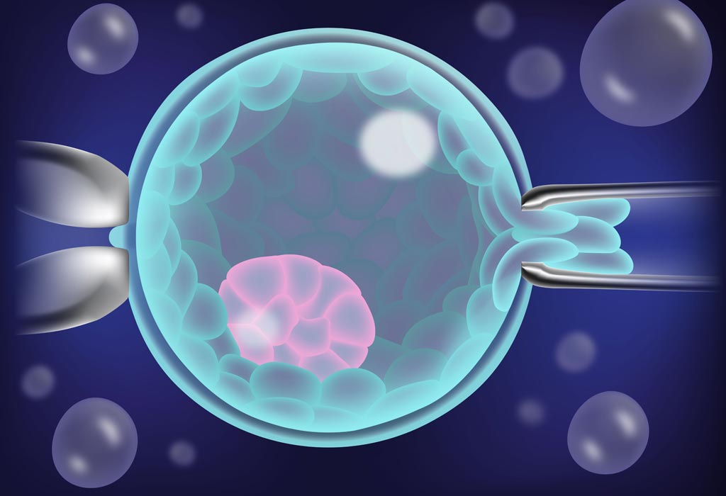 Are there risks associated with Pre-Implantation Genetic Testing ?