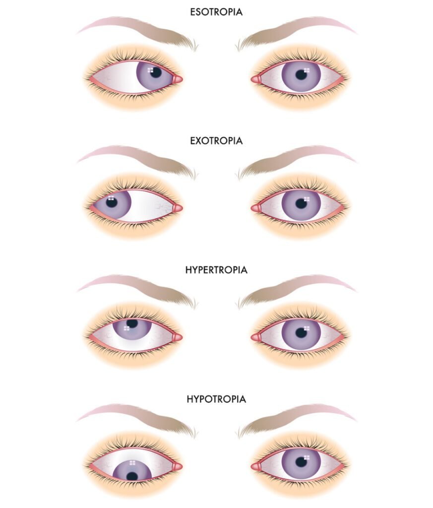 Eye Specialist in Ghatkopar