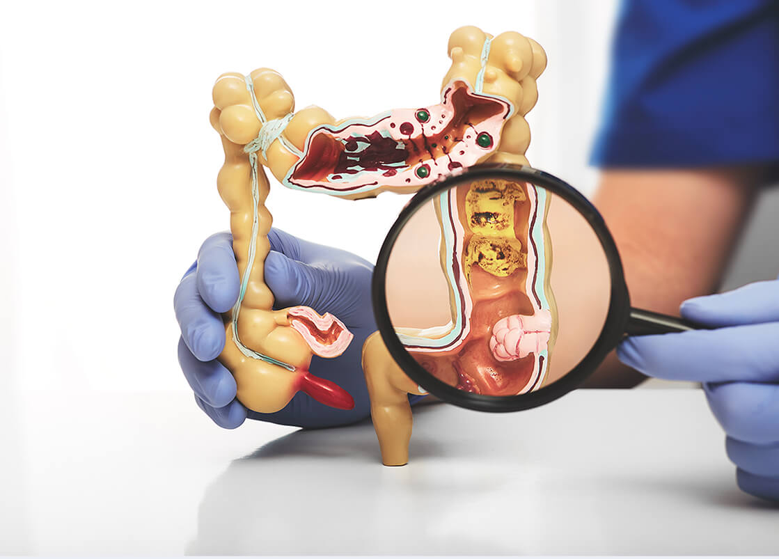 Gastrointestinal Doctor in Mumbai