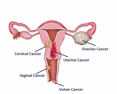 How do hormonal changes, pregnancy, and menopause affect the risk of these cancers?