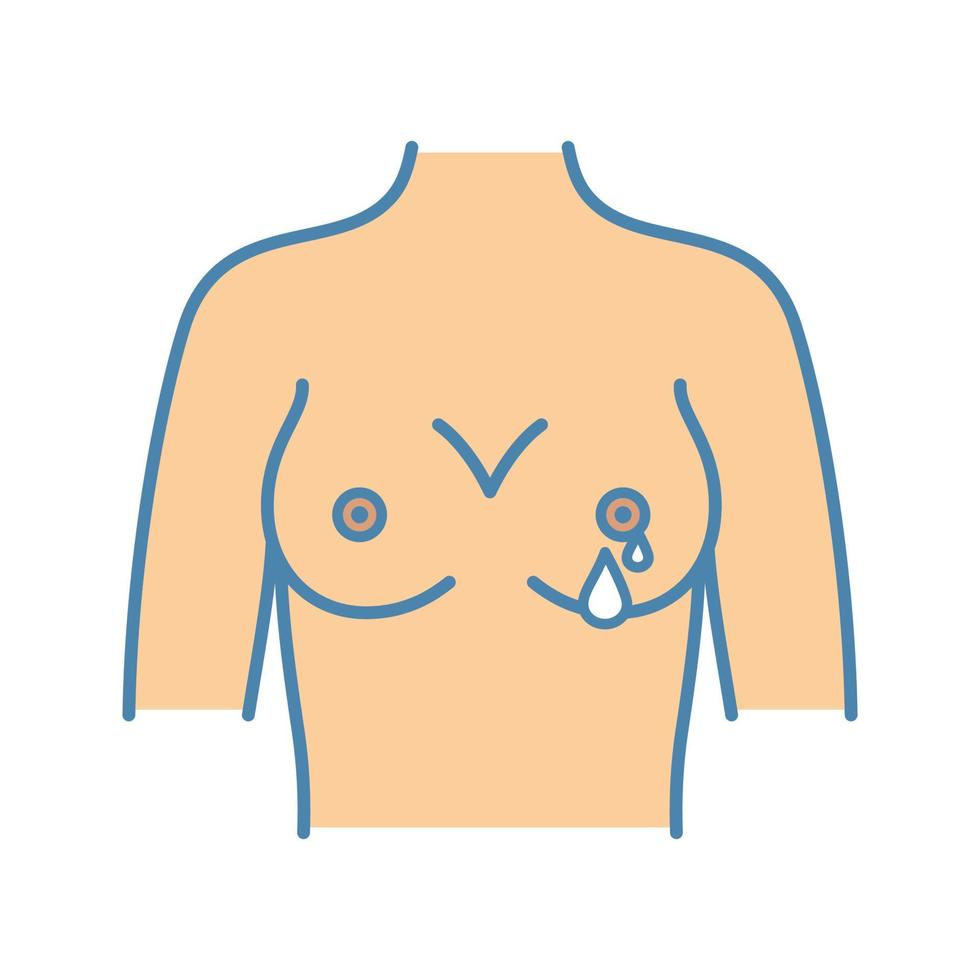 Breast Cancer Surgeon in Delhi