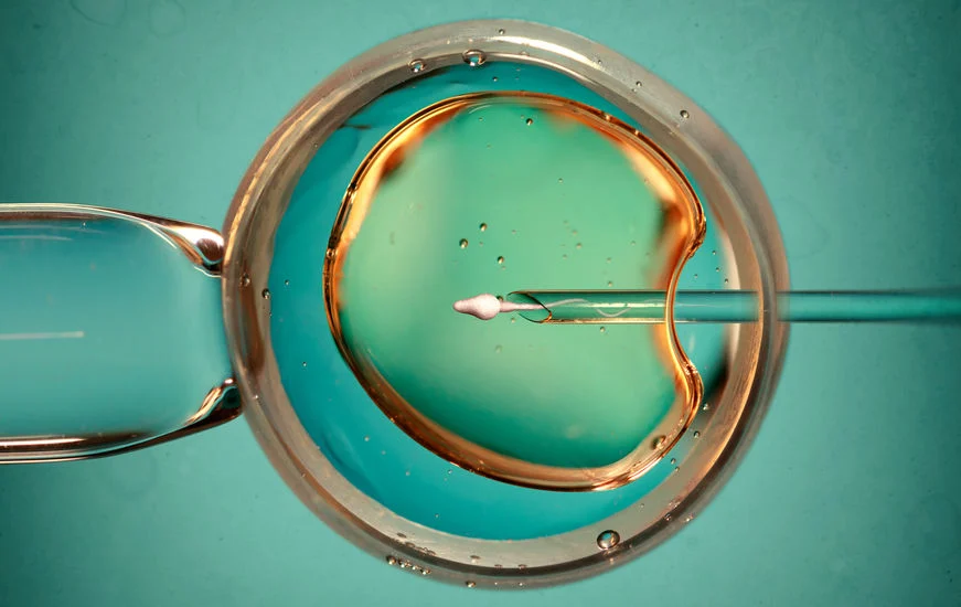 How many IVF cycles are typically needed?