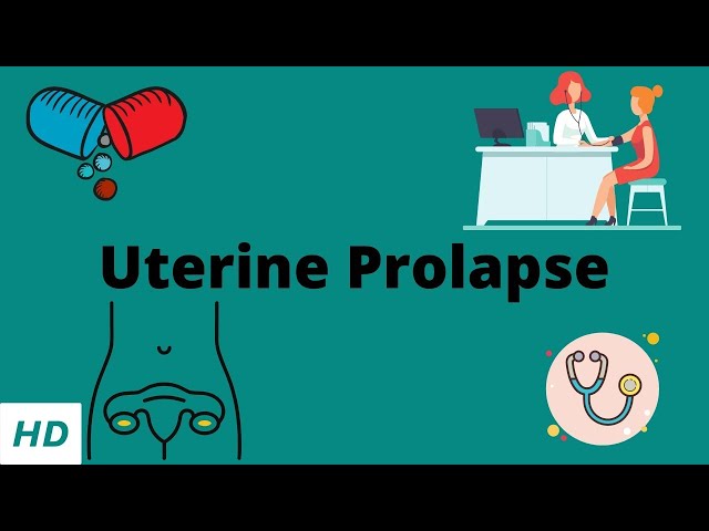 How is Uterine Prolapse Diagnosed?