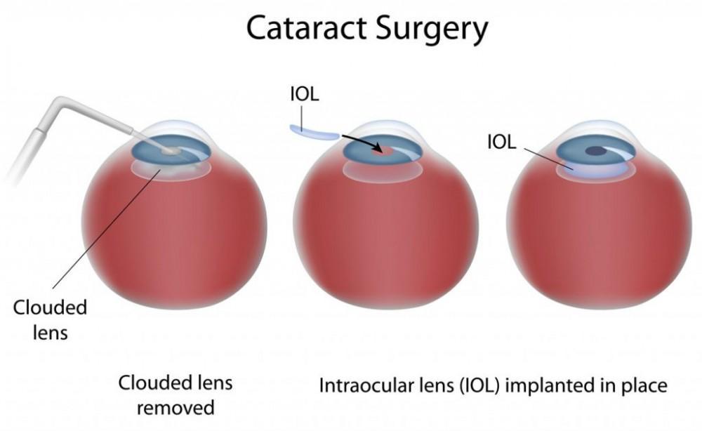 Ophthalmologist in Andheri West | Dr. Seema Behl