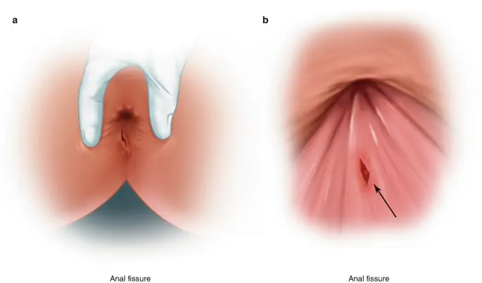 Gastrointestinal Surgeon in Mumbai | Dr. Chintamani Godbole