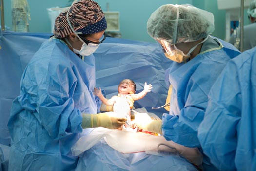 When is a C-section recommended?