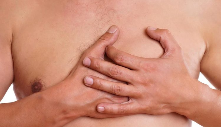 What causes male breast cancer?