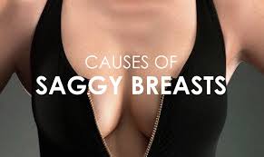 What causes sagging of breasts?