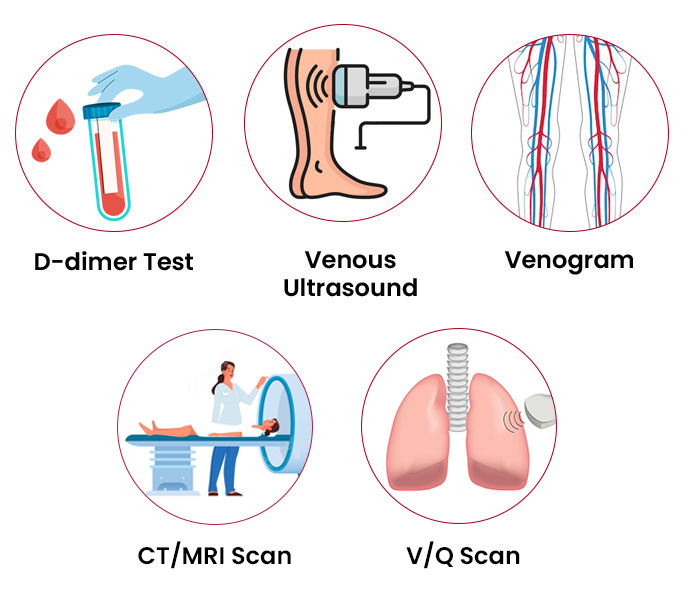 How to diagnose deep vein thrombosis?