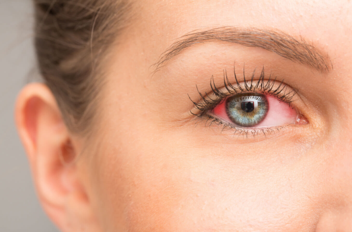 Dry Eye Checkup Treatment in Andheri