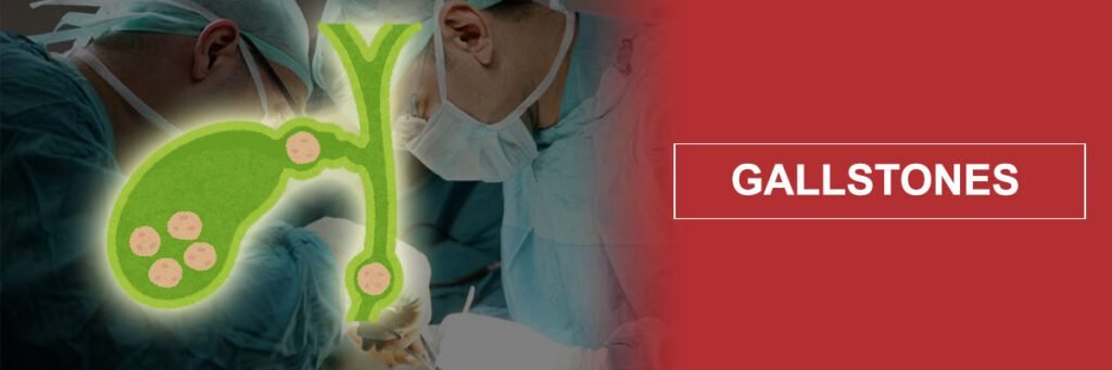 GALLSTON TREATMENT IN MUMBAI