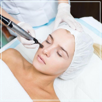 What conditions can micro needling treat?