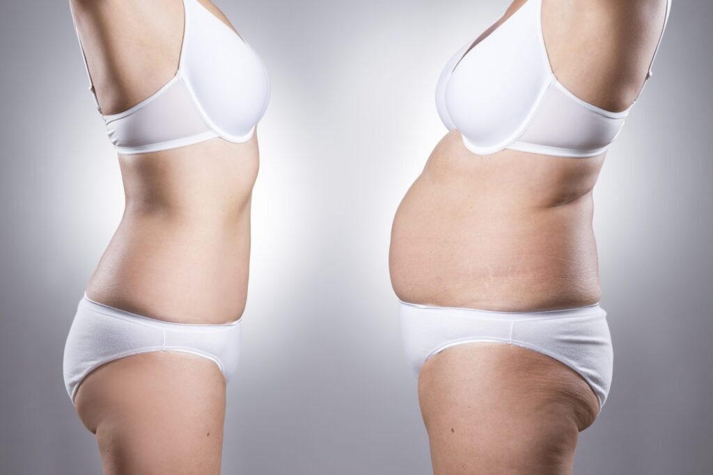 Tummy Tuck Surgery in Mumbai