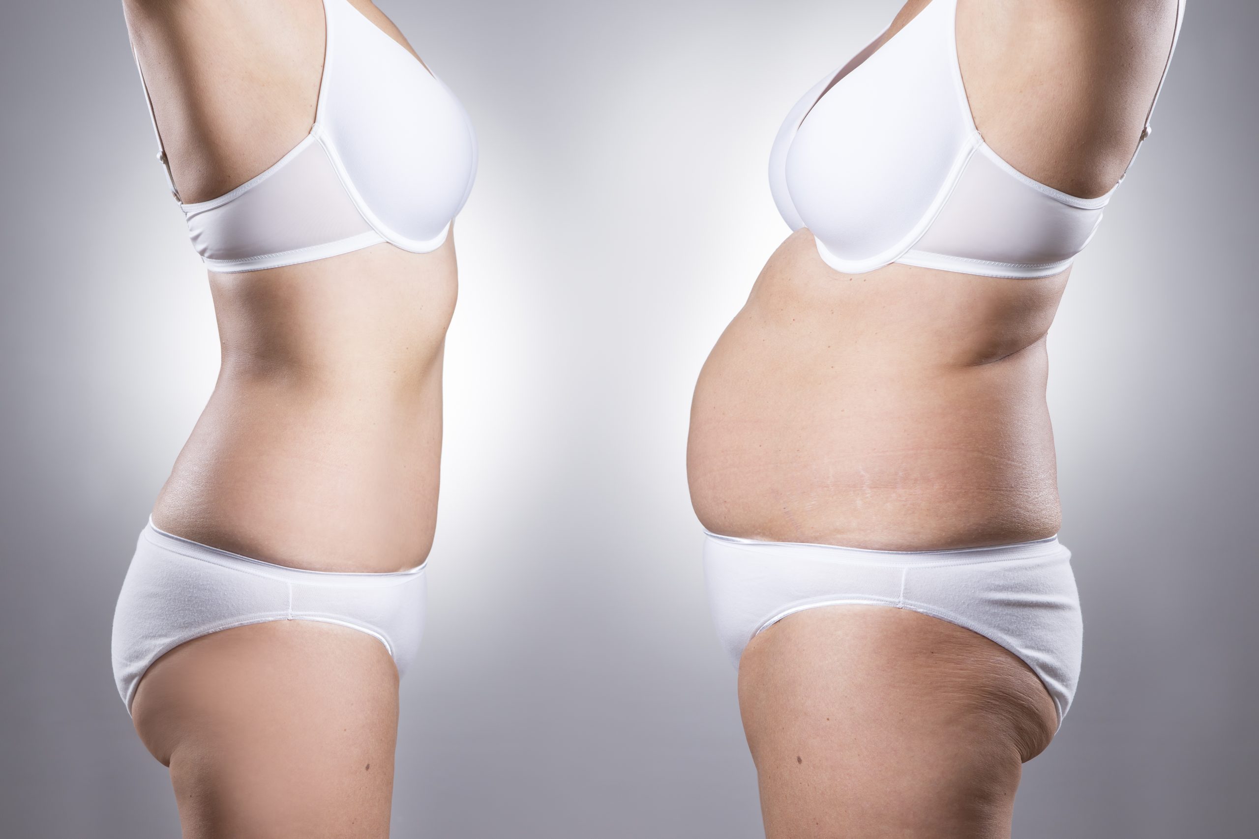 Can I still have children after a tummy tuck?