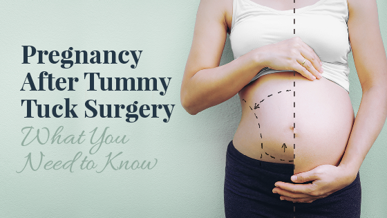 Can I have a tummy tuck after pregnancy?