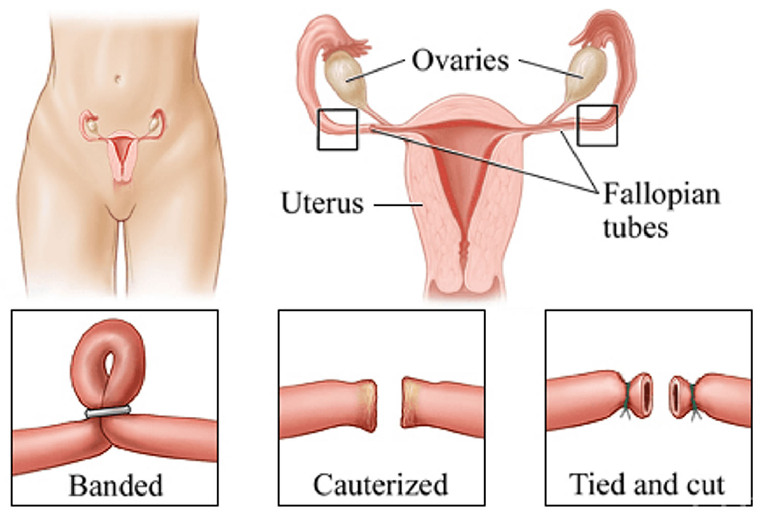 Gynaecologist in Hiranandani Estate Thane