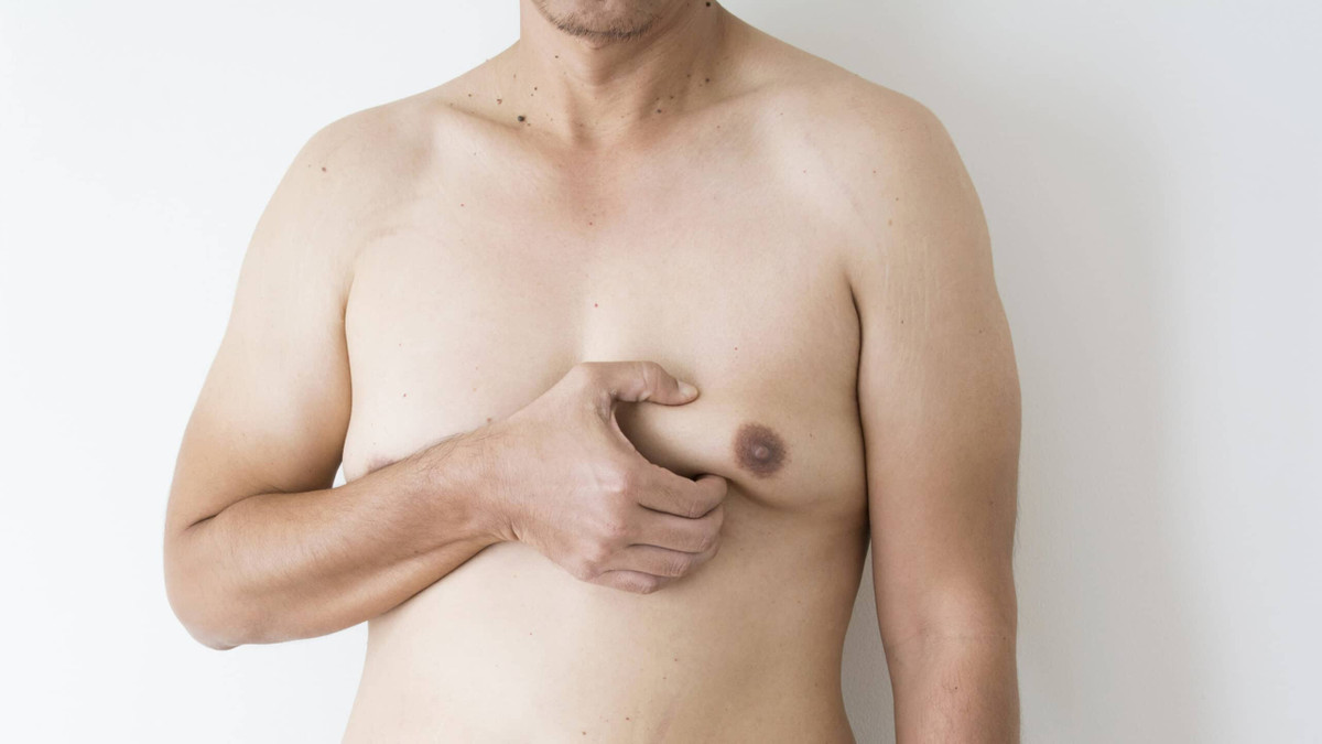 Gynaecomastia Surgery in Mumbai