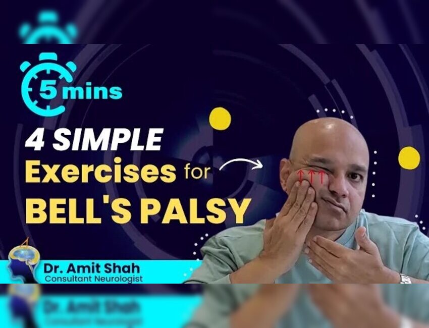 Comprehensive Bell’s Palsy Treatment in Mumbai with Dr. Amit Shah