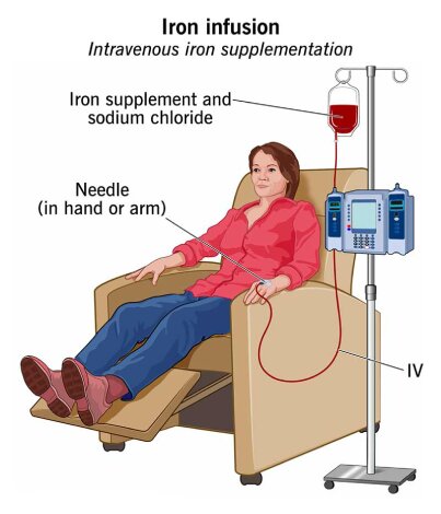 IV Infusion Therapy in Mumbai IV Infusion Therapy in Mumbai