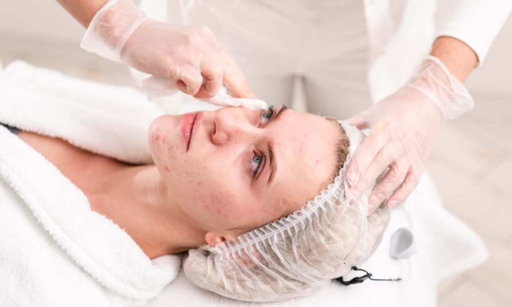 Pimple Treatment in Mumbai Pimple Treatment in Mumbai