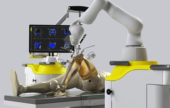 Arthroscopic ACL Reconstruction in Bangalore Arthroscopic ACL Reconstruction in Bangalore