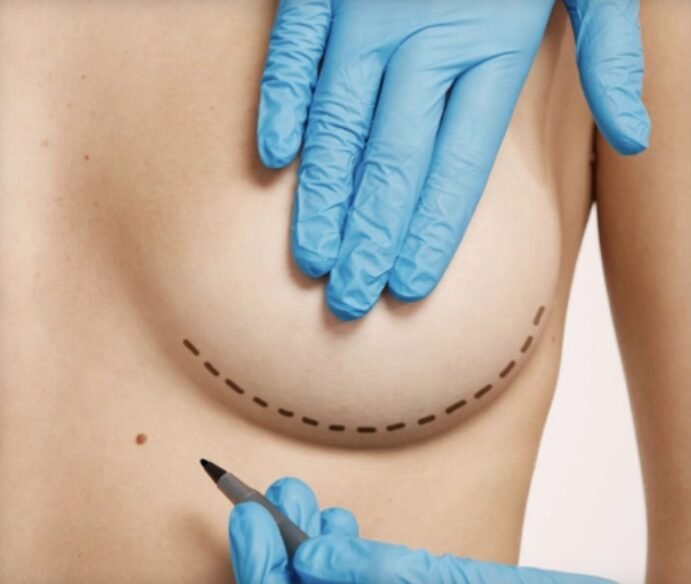 Breast Reduction Surgery in Mumbai