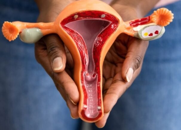 Ovarian Cancer Debulking Surgery Ovarian Cancer Debulking Surgery
