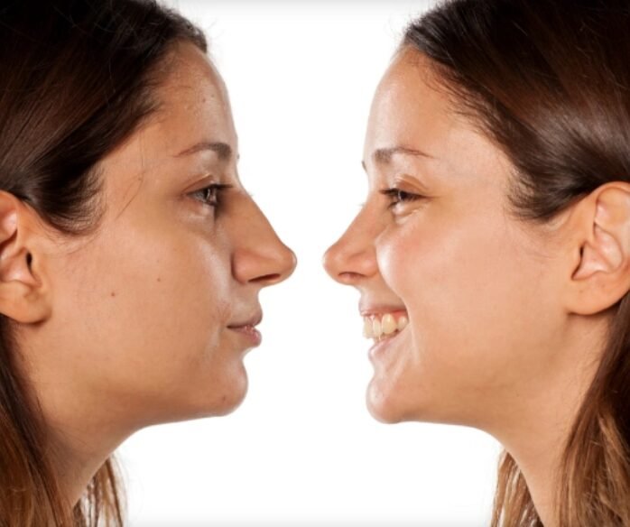 Rhinoplasty surgeon in Mumbai