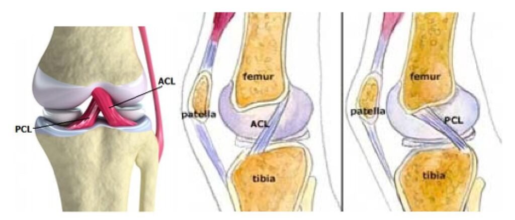 Reporting from the Clinic: Arthroscopic PCL Reconstruction in Bangalore Doctor Near Me Arthroscopic PCL Reconstruction in bengalore