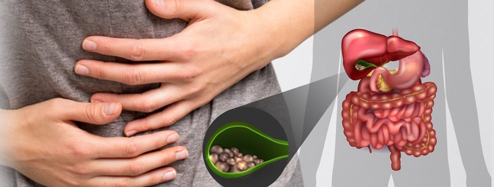 Gallstone Treatment in Mumbai