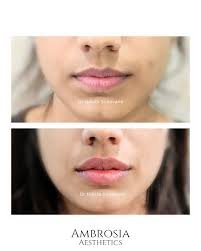 A Medical Journalist’s Insight into Skin Whitening Treatment in Mumbai Doctor Near Me skin whitening treatment in mumbai
