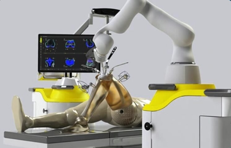 Robotic Total Knee Replacement Surgery in Bangalore
