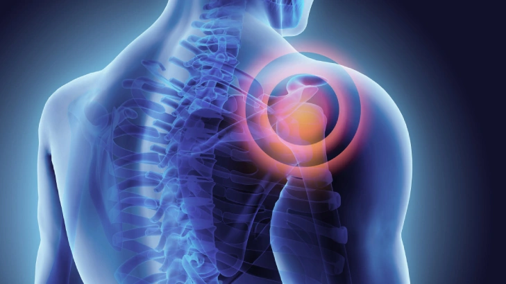 An On-Ground Clinical Perspective from Opera Bone and Joint Clinic Doctor Near Me frozen shoulder treatment in bangalore