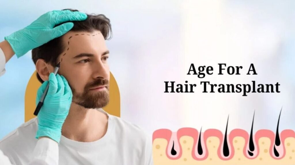 Best Age For A Hair Transplant