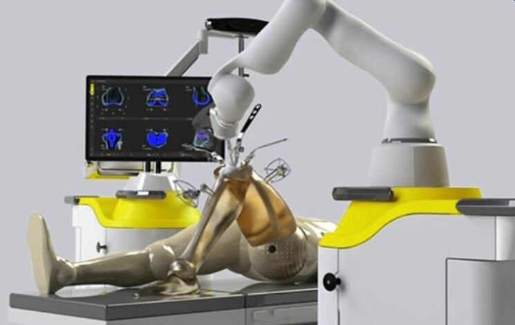 Robotic knee replacement surgery in Bangalore